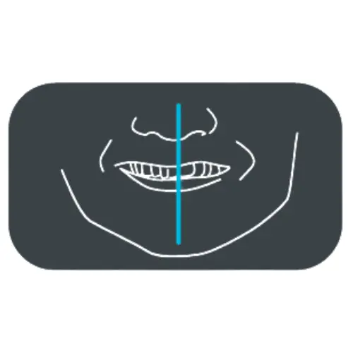 Acteon X-Mind Optima 3D